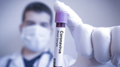 Koronavirüs Salgınının Sözleşmelere Etkileri