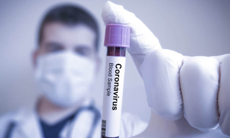 Koronavirüs Salgınının Sözleşmelere Etkileri
